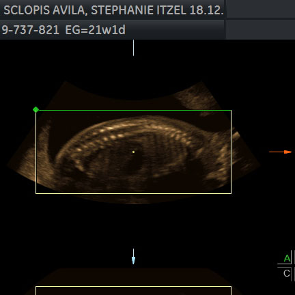 ecografia-fetal-panama